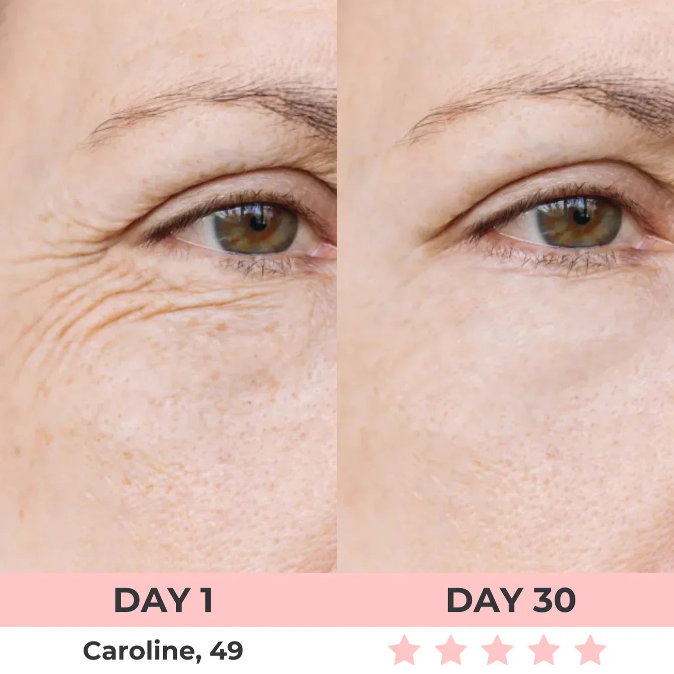 60% OFF + FREE SHIPPING🔥CYBER MONDAY SALE ENDS TONIGHT💝AURORA 7-in-1 LED Facial Sculptor