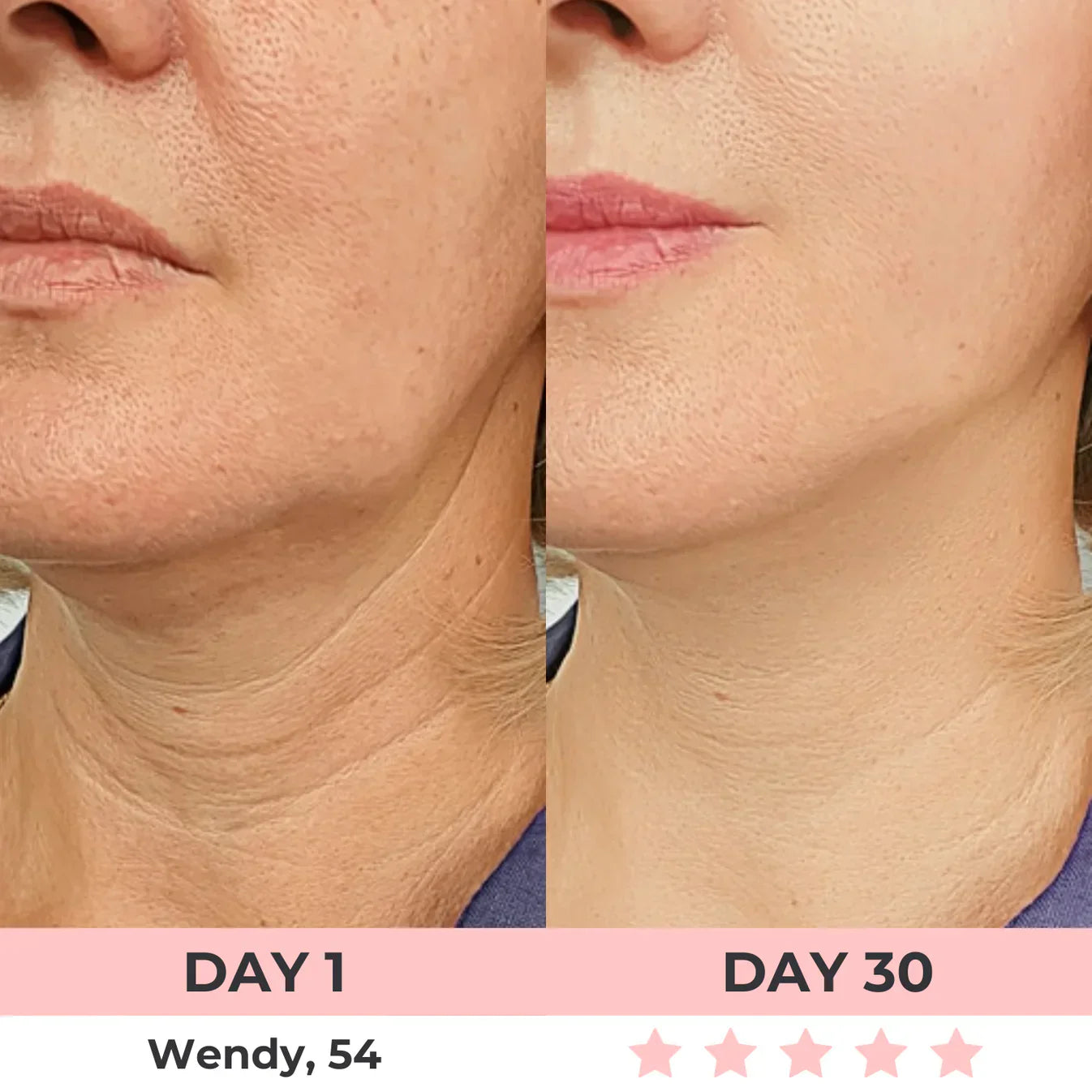 60% OFF + FREE SHIPPING🔥CYBER MONDAY SALE ENDS TONIGHT💝AURORA 7-in-1 LED Facial Sculptor