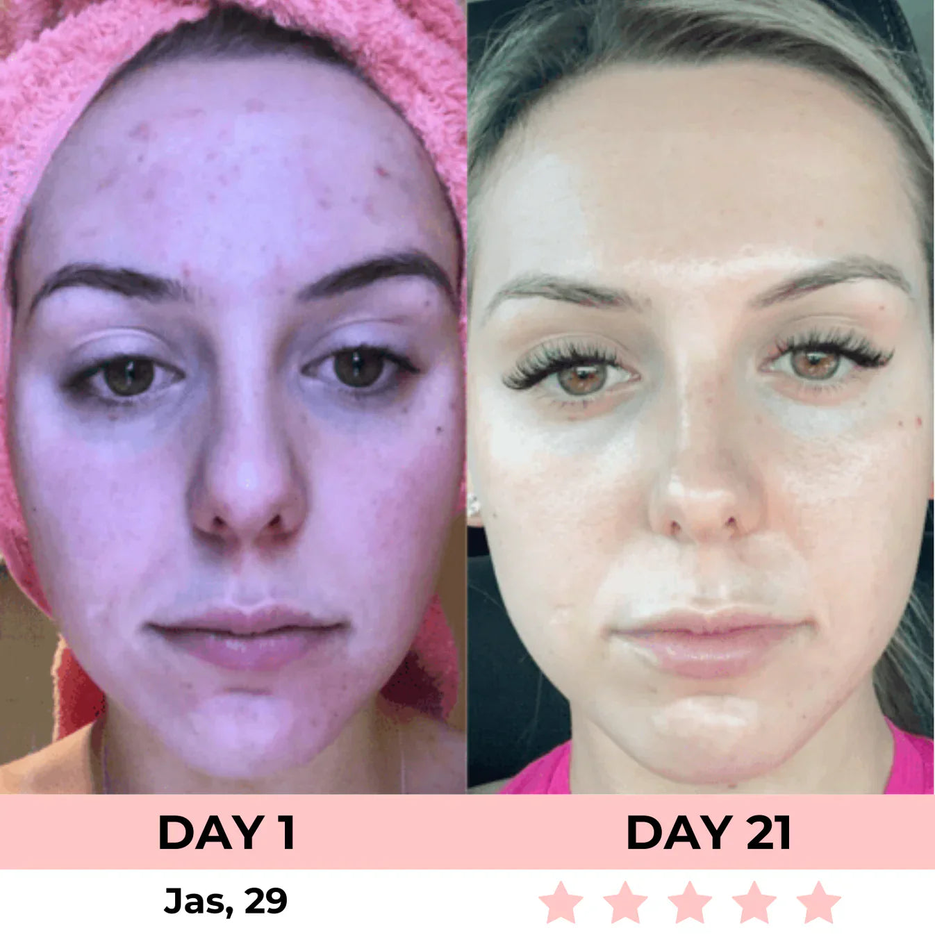 60% OFF + FREE SHIPPING🔥CYBER MONDAY SALE ENDS TONIGHT💝AURORA 7-in-1 LED Facial Sculptor